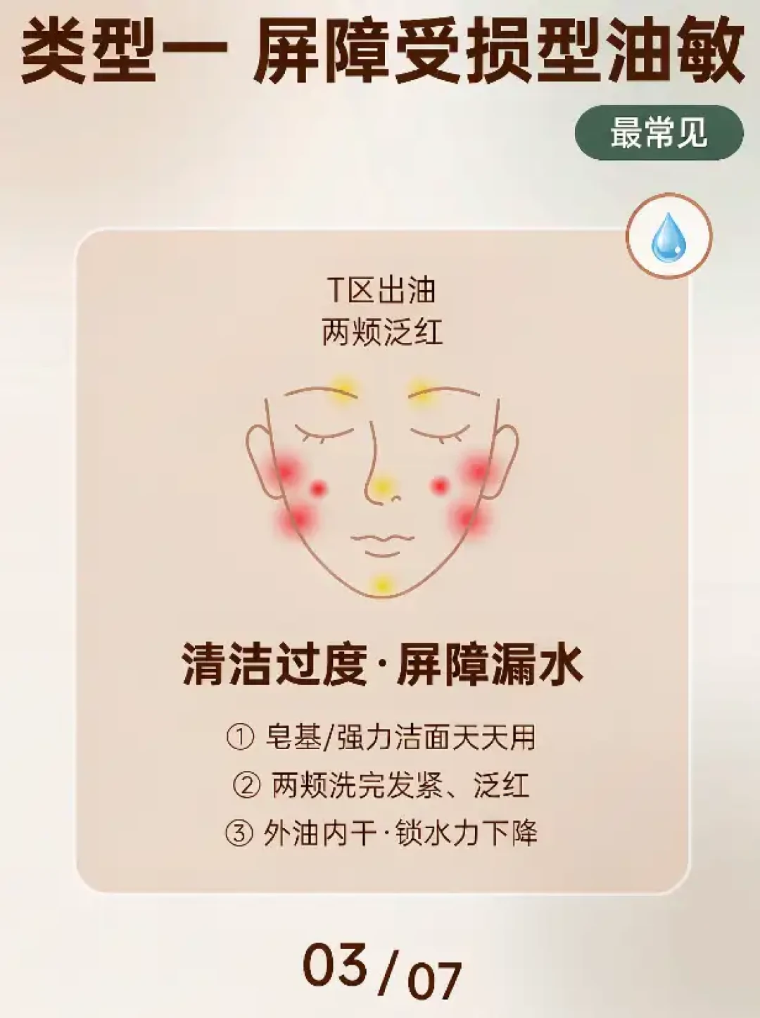 九月的“外油内干”帖又刷屏:对完8294赞“这是脂皮”反贴、评论区互掐的自救法和三条过度水合警告,先别急着买补水或控油的,花30秒看清你的“干”是哪种