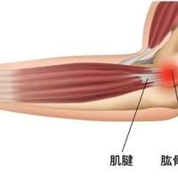 「太贵只买了一只」的护肘帖和5286收藏的头绳帖对上了：翻完全网网球肘装备线，先弄清你箍的是肌肉还是骨头，再掏钱