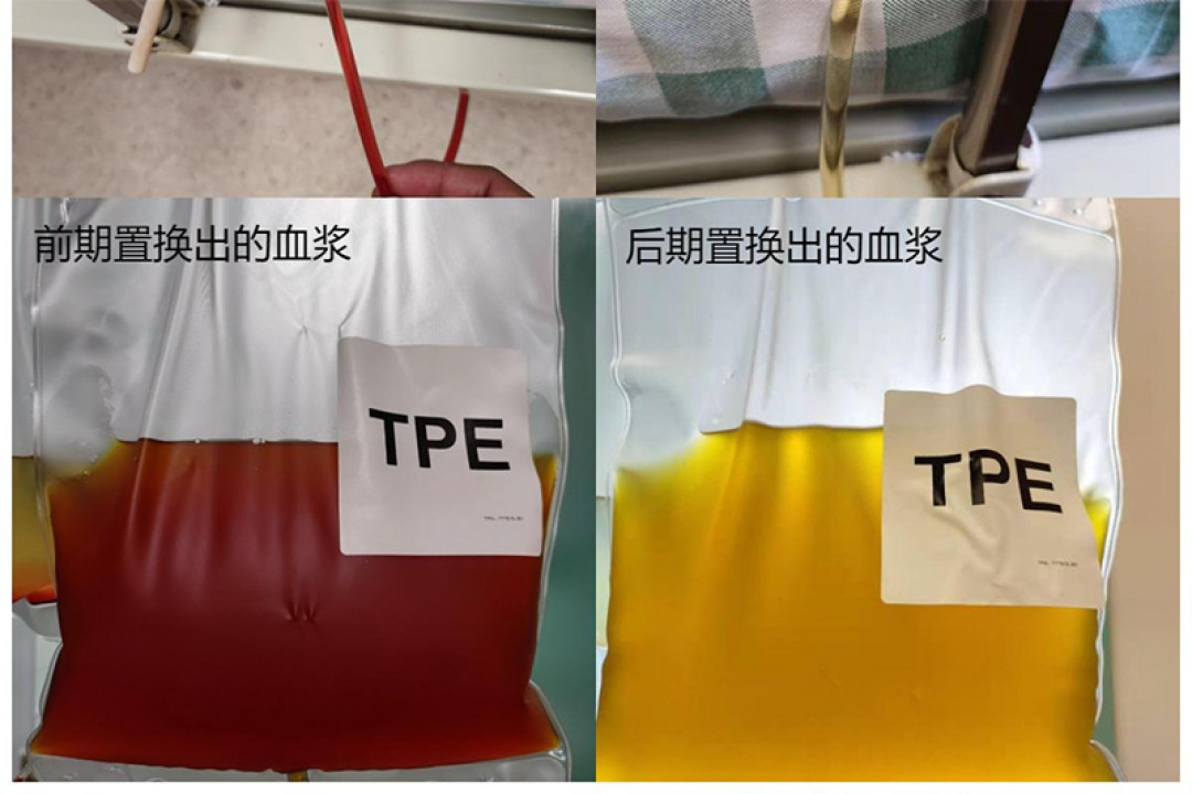 卫健委刚给