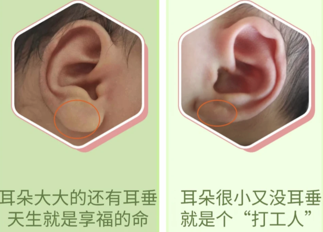 耳垂是享福的命？先别乐，它可能是你全脸最没人管的一块皮