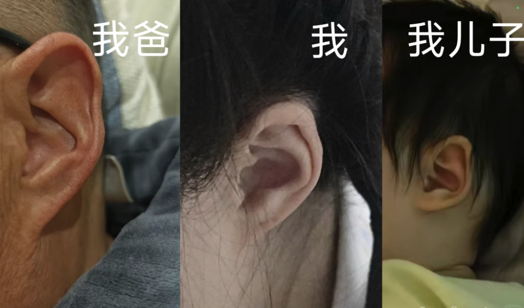 耳垂是享福的命？先别乐，它可能是你全脸最没人管的一块皮