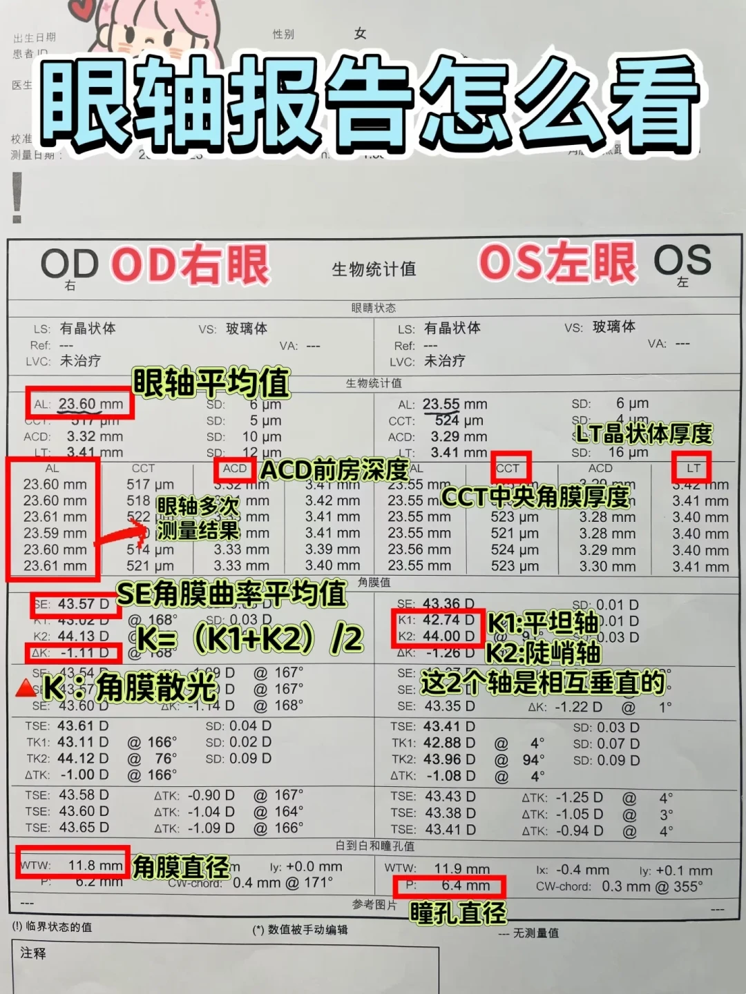 医疗版星趣控三个月挂花报废、眼轴弹回原点：对完8~12小时的佩戴时长共识和两条277、337条评论大帖里的两派账本，复查数据难看时先审计家里这三件事