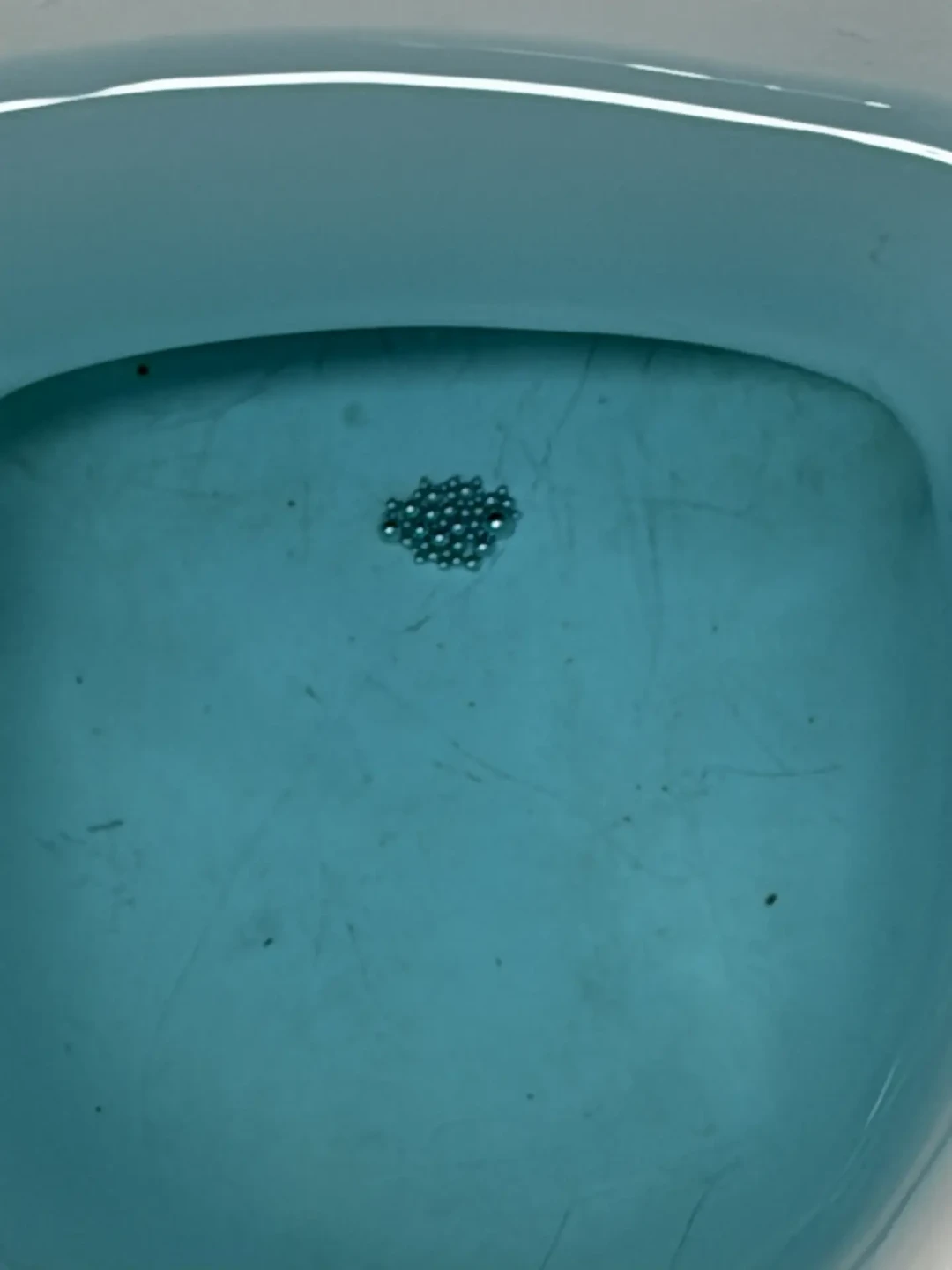 水银体温计禁产未禁售：一支400岁