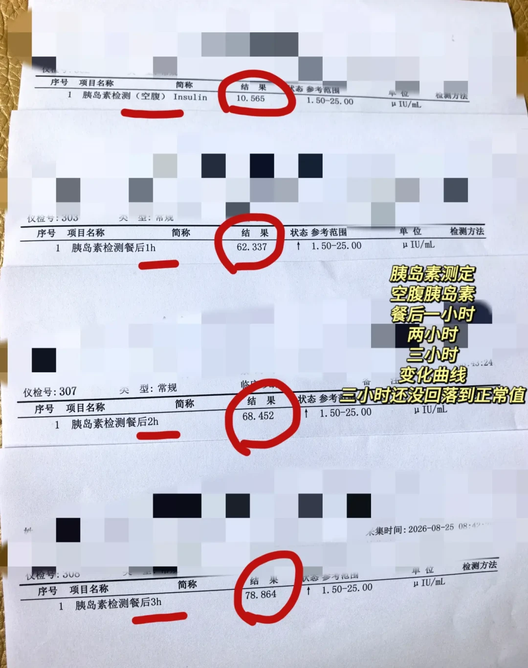 「多囊」改名了：病历和药都不用动，但这项两百元内的检查建议你尽快补上