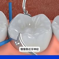 换季自查与龋齿提醒 | 口腔保健9.14日报