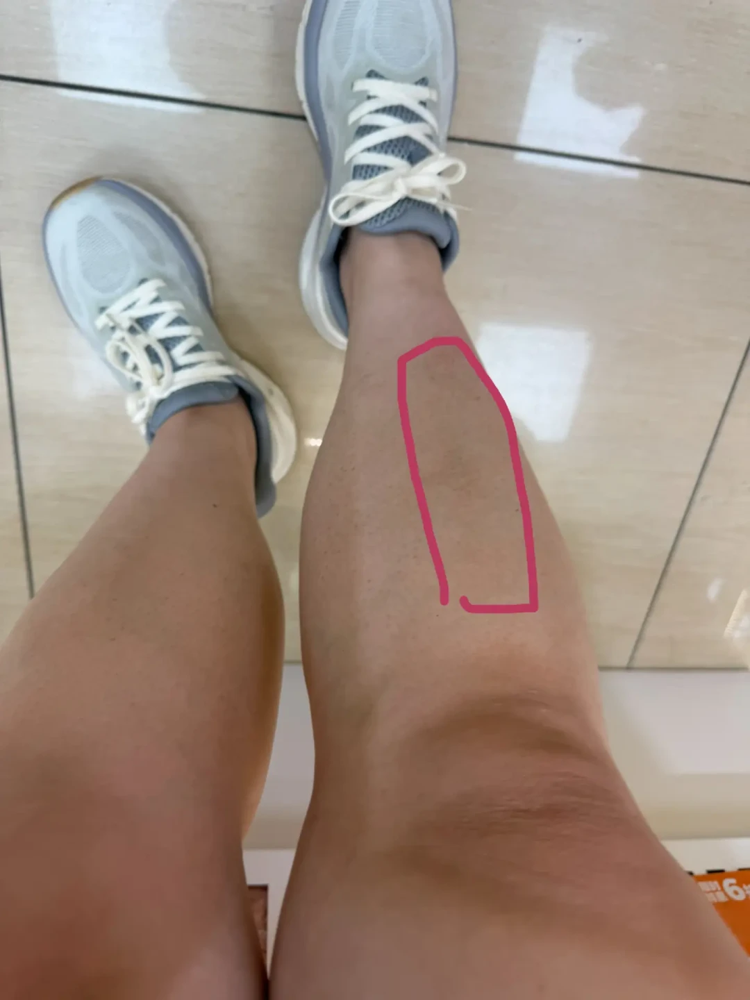 九月复训潮一到,一半跳绳党的小腿又开始疼:这张分诊表,分清哪种疼能扛、哪种绝对不能