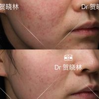 泛红修护、精简防晒 | 敏感肌护肤9.14日报