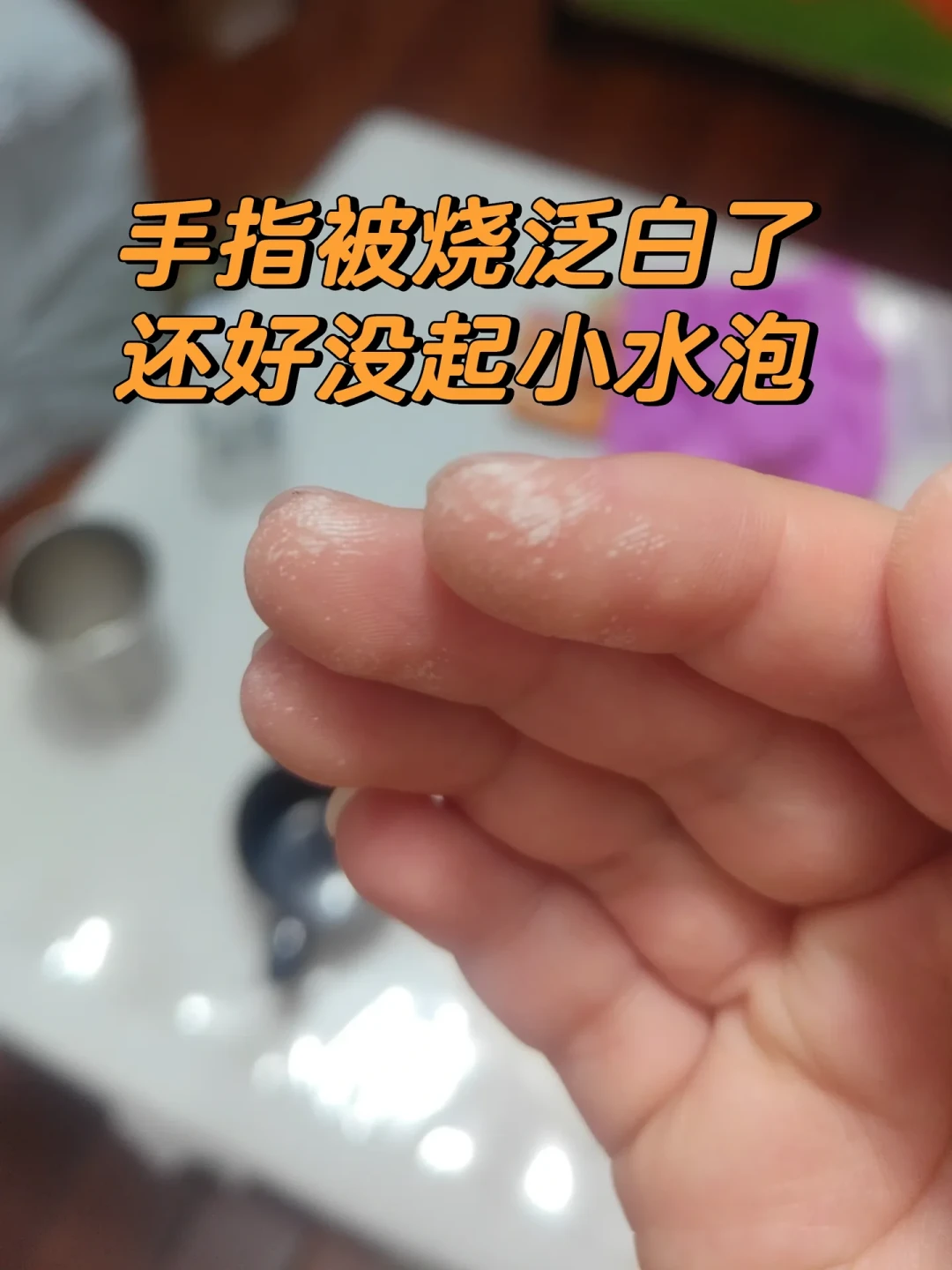 空调外壳黄了、收纳箱黄了?先别急着擦牙膏、下单除黄剂:分清「脏黄」和「老化黄」,再决定擦、敷还是换