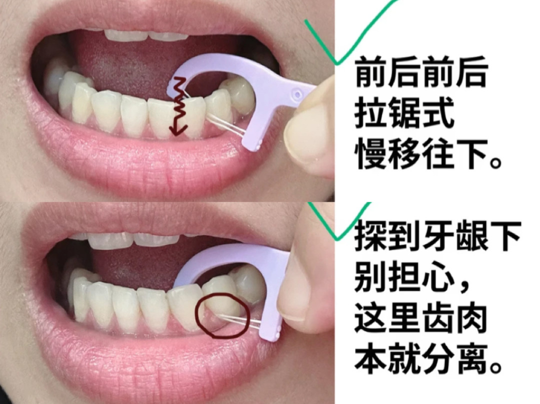 牙线棒用法