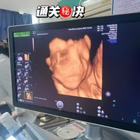 大排畸一次过✅通关秘籍，宝宝超配合✌️