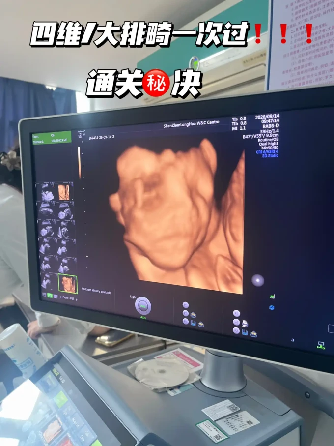 妈妈护理