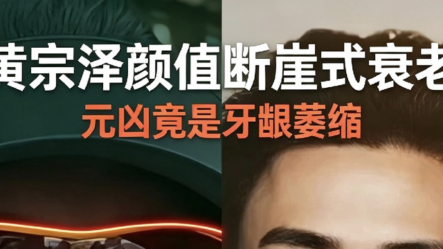 黄宗泽颜值断崖式衰老，元凶竟是牙龈萎缩