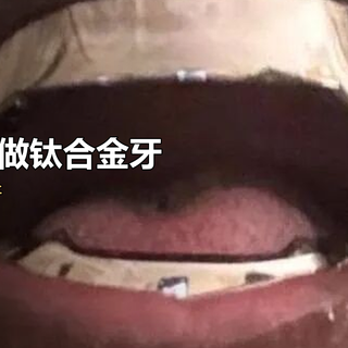 侃爷花612万给自己装钛合金牙，我看完默默约了个洗牙