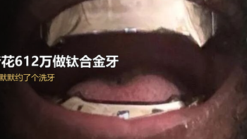侃爷花612万给自己装钛合金牙，我看完默默约了个洗牙