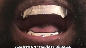 侃爷花612万给自己装钛合金牙，我看完默默约了个洗牙