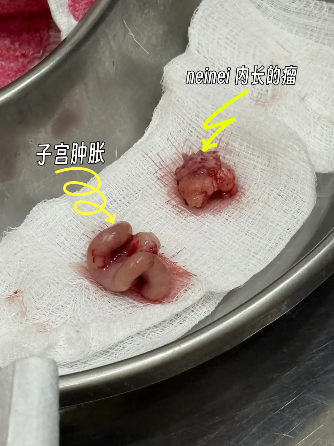 「直接去绝育吧,大概1000多」vs「这种异宠做绝育风险很高,没必要」:深夜「粉色尿」求助帖下评论区吵翻,母刺猬绝育决定前,先把千分之一、6-12个月、200块拍片和4000块摘除这四笔账算清