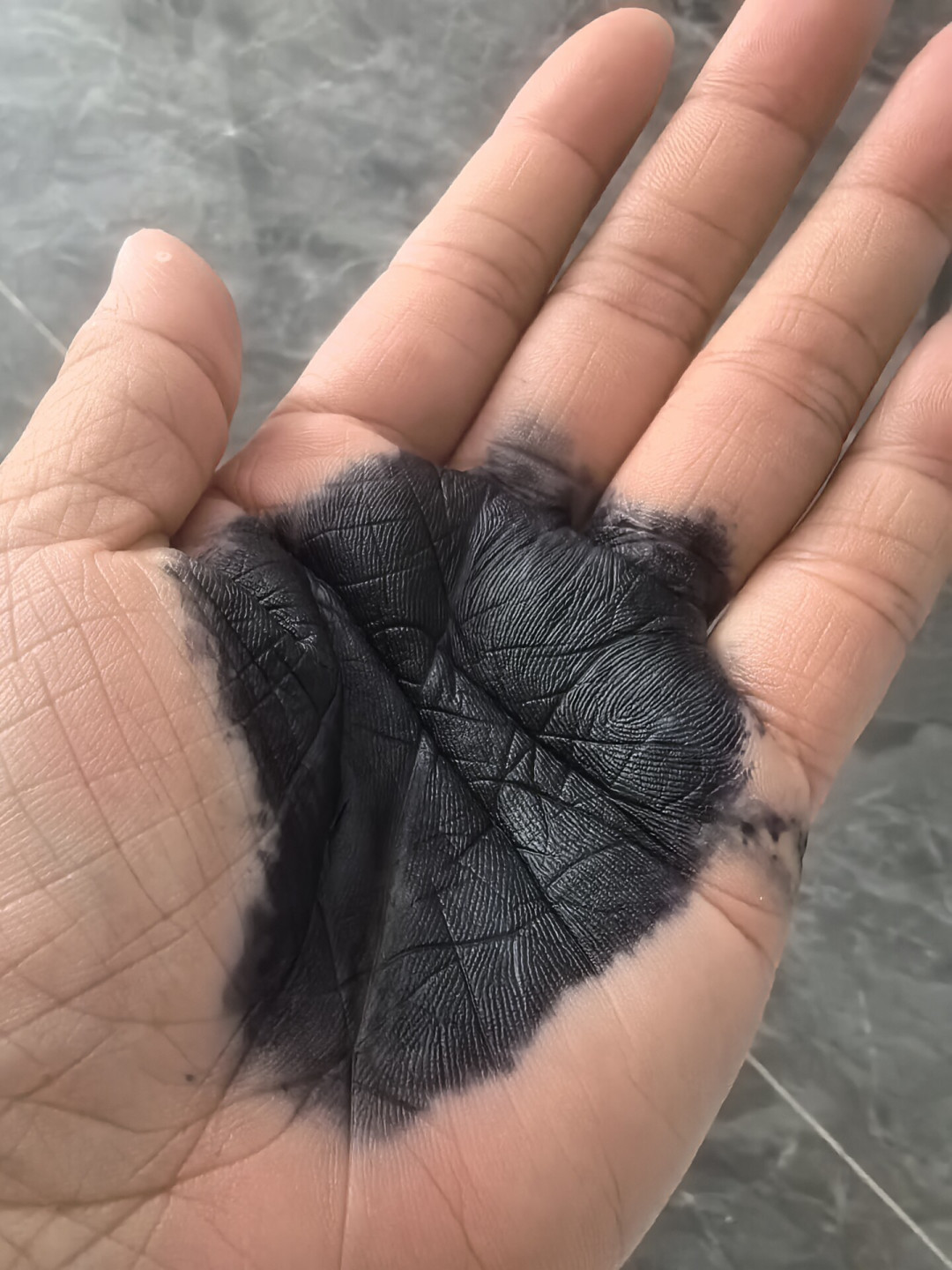 骨科说它是染色剂，苏州人叫它神药：那包5块钱的雷允上吊筋药，敷之前先算清三笔账