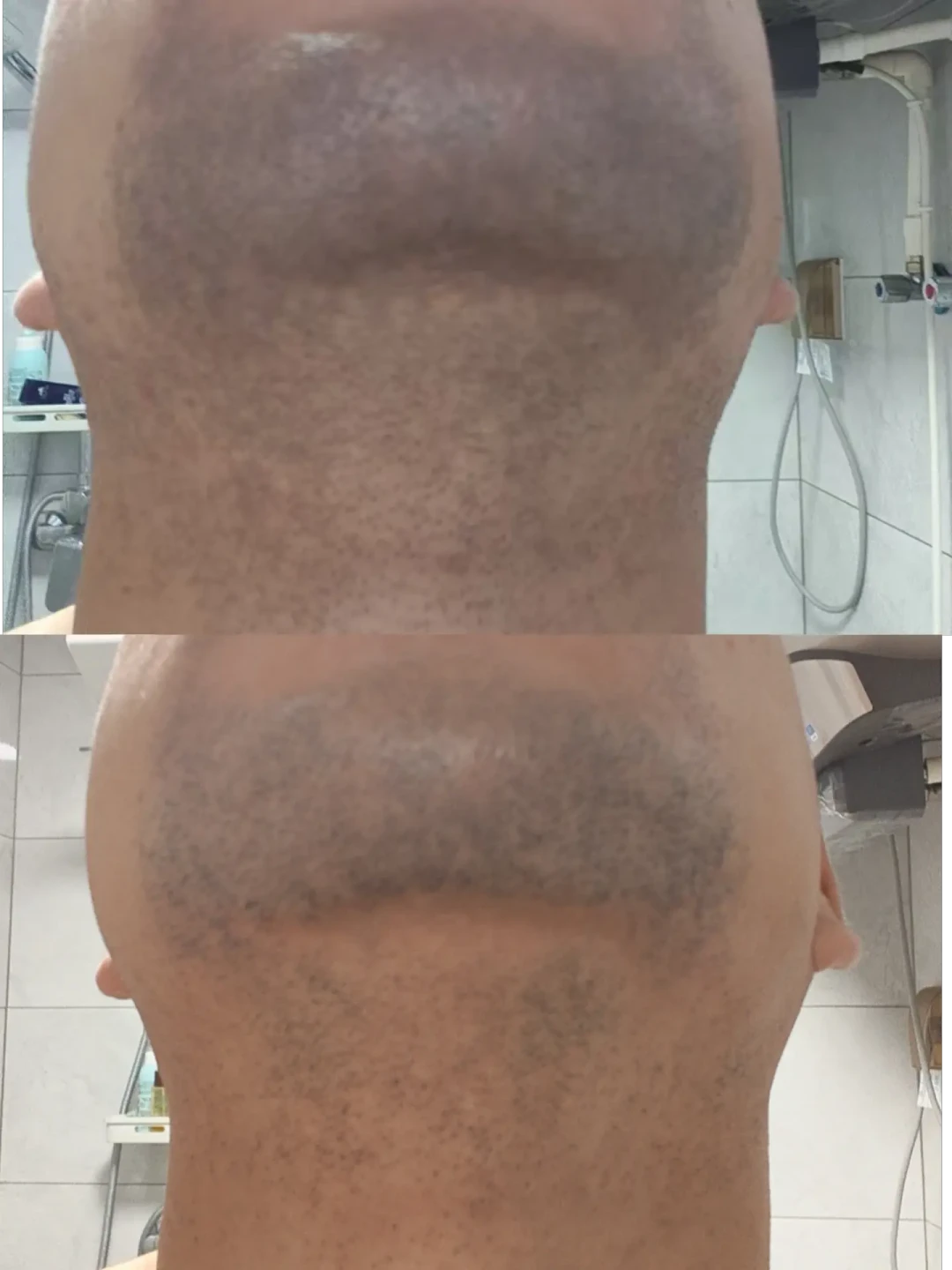 胡子刮到不能再短,脸还是青的:男士