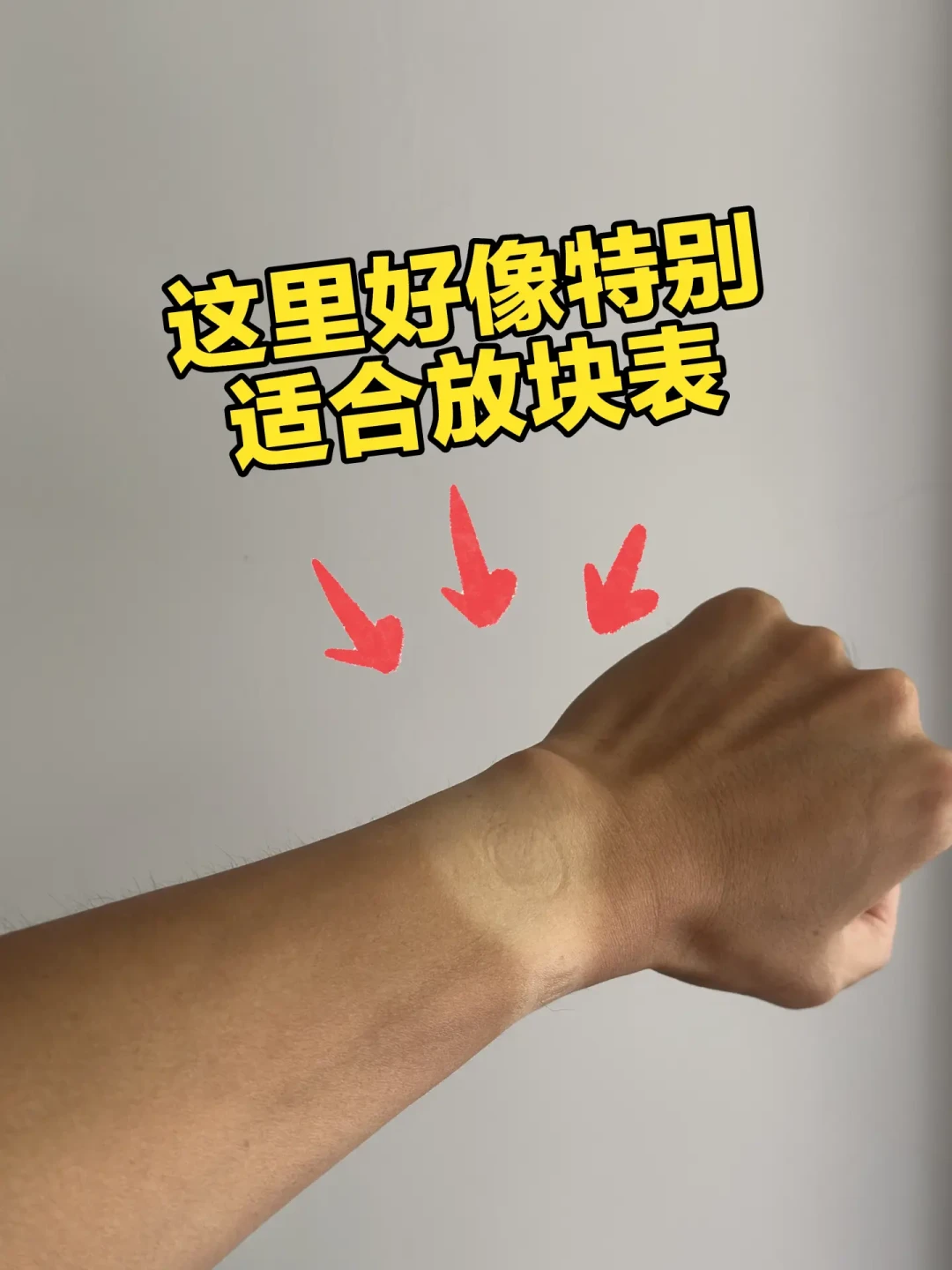 「第一批戴运动手环的受害者」爆了11天:对完果壳的19篇文献、78%的刺激性皮炎、1219赞的晒痕顶评和964条换表带实录,你手腕的白印发痒该换表带、改习惯还是就医,我替你排清了