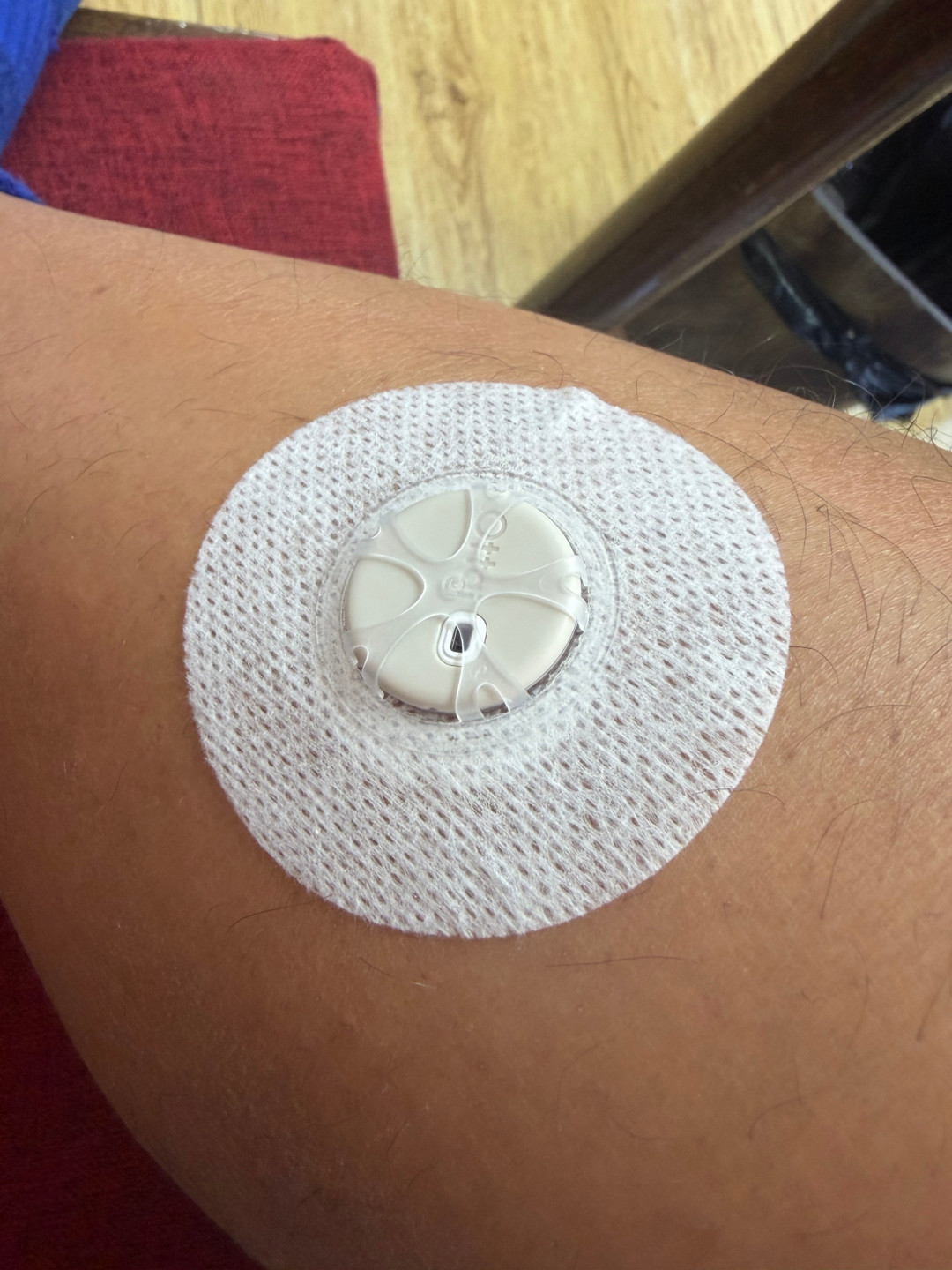 健康人排队戴上动态血糖仪测食物升糖:中国青年报已点破