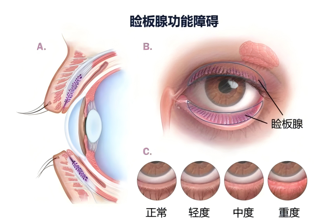 入秋后