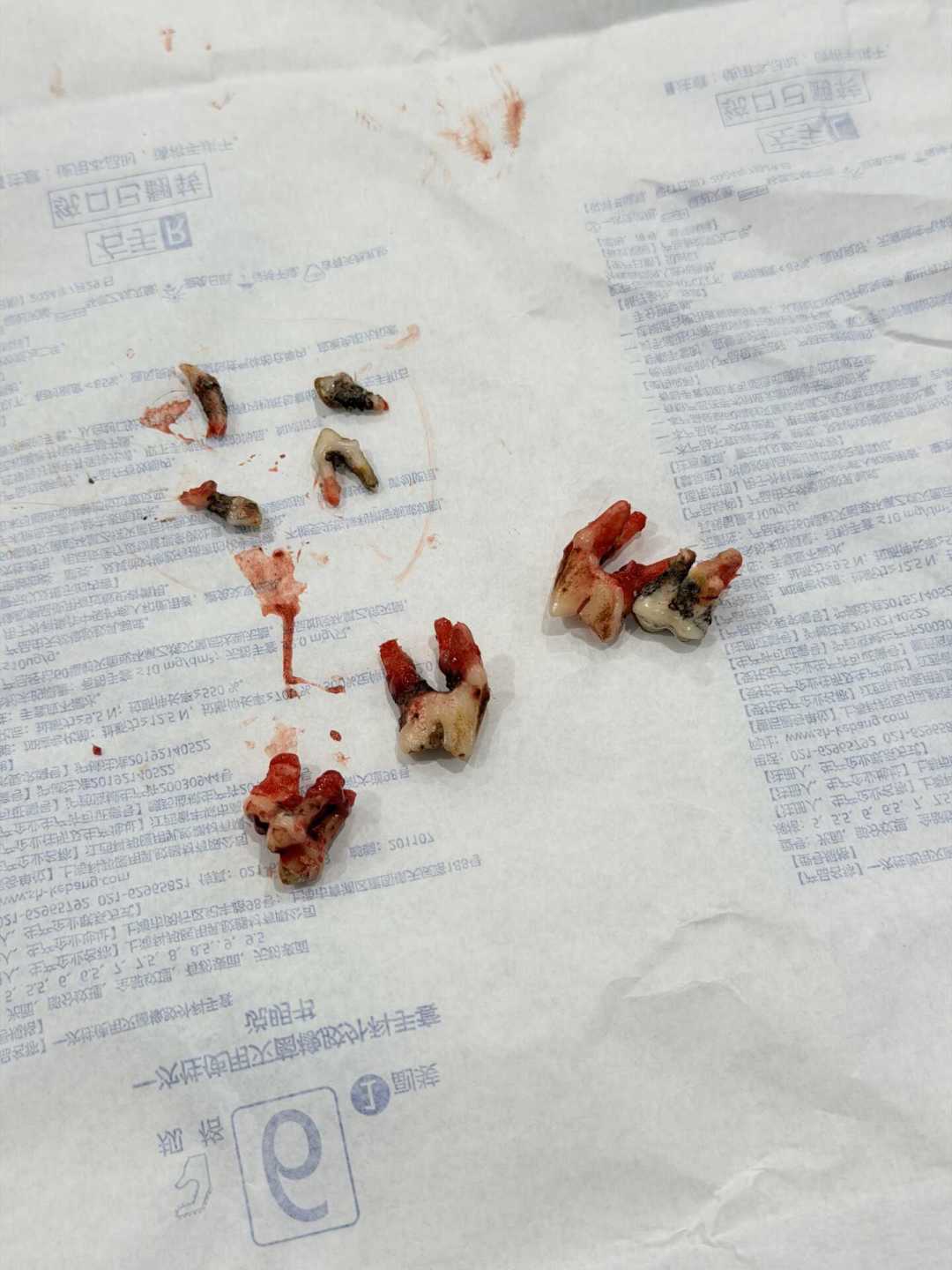 大狗口臭不是刷牙的事:拆完全网晒出的洗牙账,520到4000的差价里,真正贵的是“还能麻醉”那几年