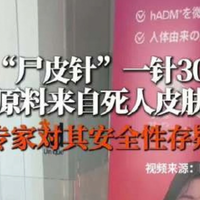 3000元的「尸皮针」号称可重返20岁？为什么在国内不合规