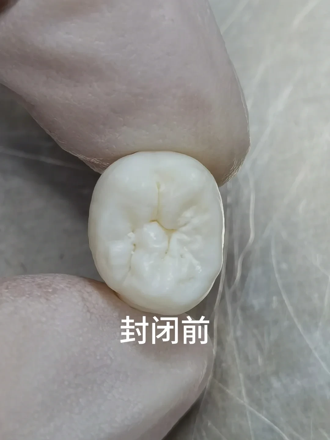 刷到