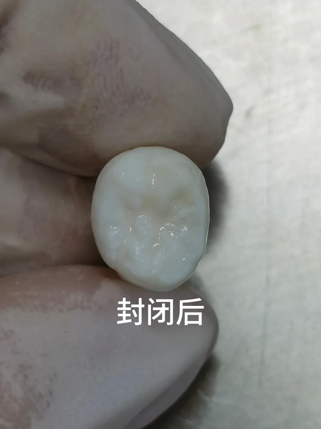 刷到
