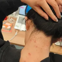 前胸后背的疙瘩多半不是