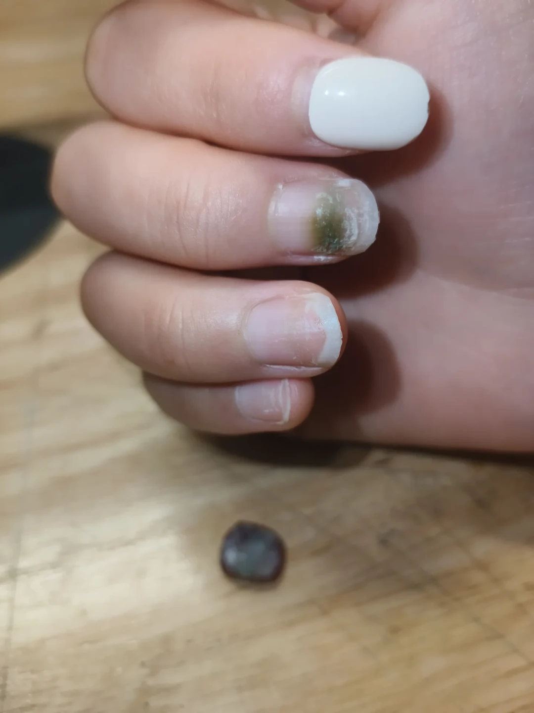 死皮剪比价签更该看:扒完4月到9月的美甲感染报道,要防的不是恐慌,是三件事