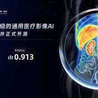 阿里AI登《科学》顶刊：一次读146种病准确率超专家，已全面开源