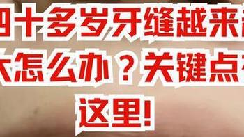 牙缝越来越大、总塞牙？不是老了，是牙周在“报警”