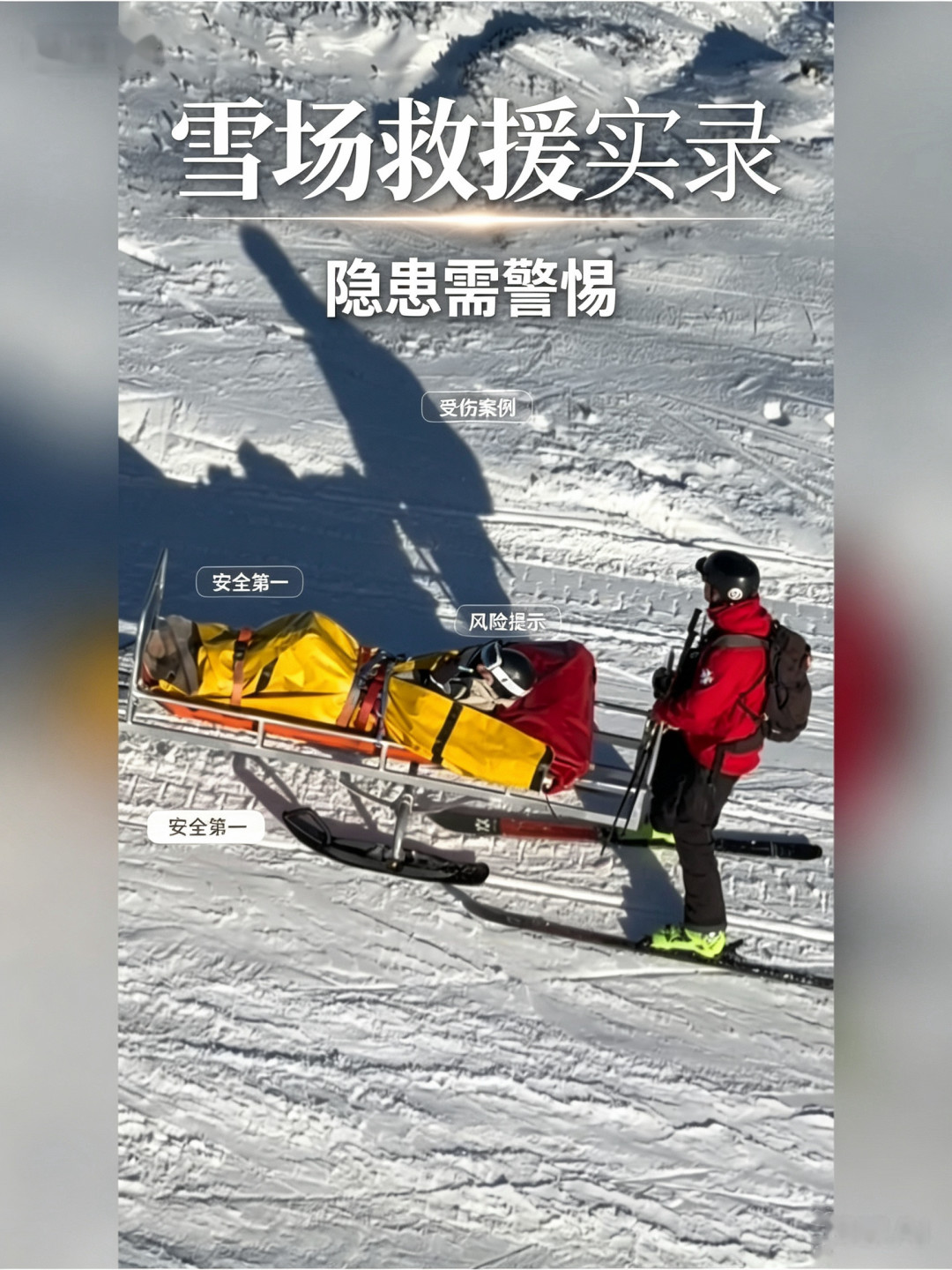 摔一跤手术3万起：雪票里自带的保险多半不赔你，26/27雪季这笔几十块的账先算明白