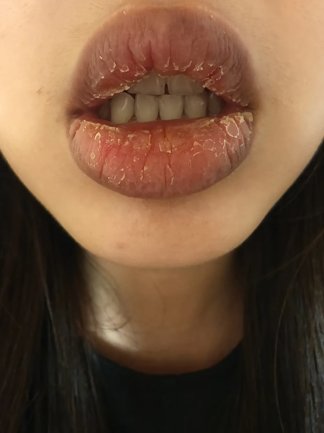 入秋嘴唇起皮季提前开闸,