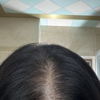 被广告喂到眼前的“拜耳防脱精华”开始有人交作业了:219的历史低价刚刷新、两拨评论吵起来了,下单前先把三本账算清