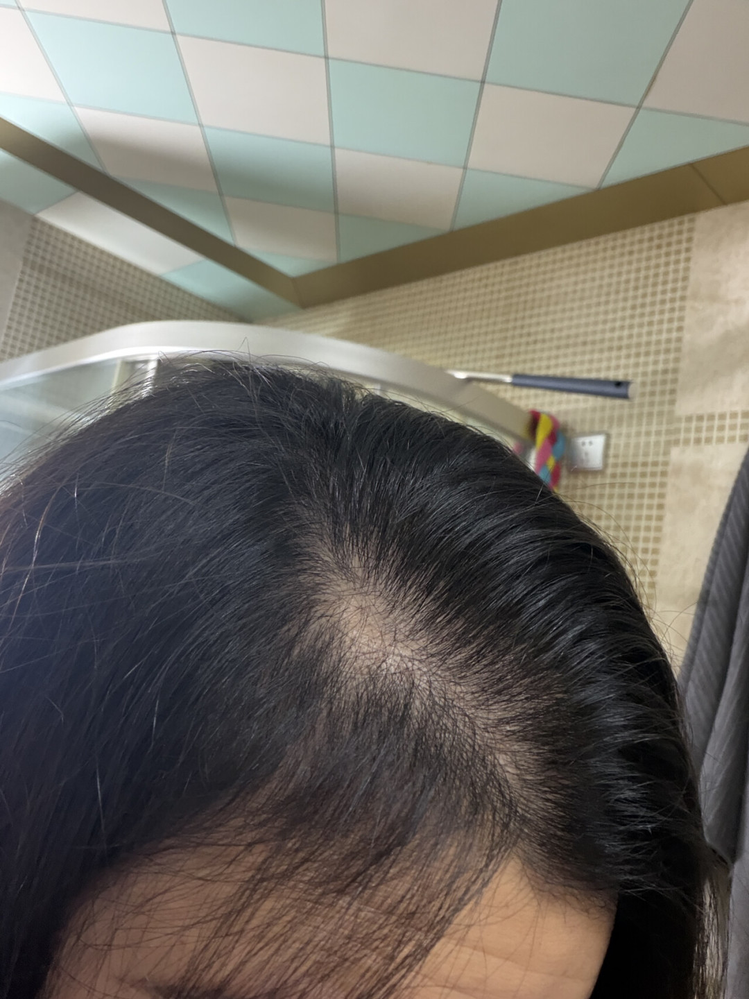 被广告喂到眼前的“拜耳防脱精华”开始有人交作业了:219的历史低价刚刷新、两拨评论吵起来了,下单前先把三本账算清