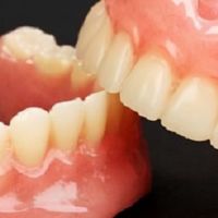 吸附性义齿能用多久？答案不是“终身”，用得好不好主要看这4点