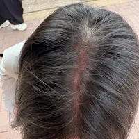 国庆去川西，最先晒伤的可能是你的头顶：翻了十几篇血泪帖，空顶帽是里面最没用的那个