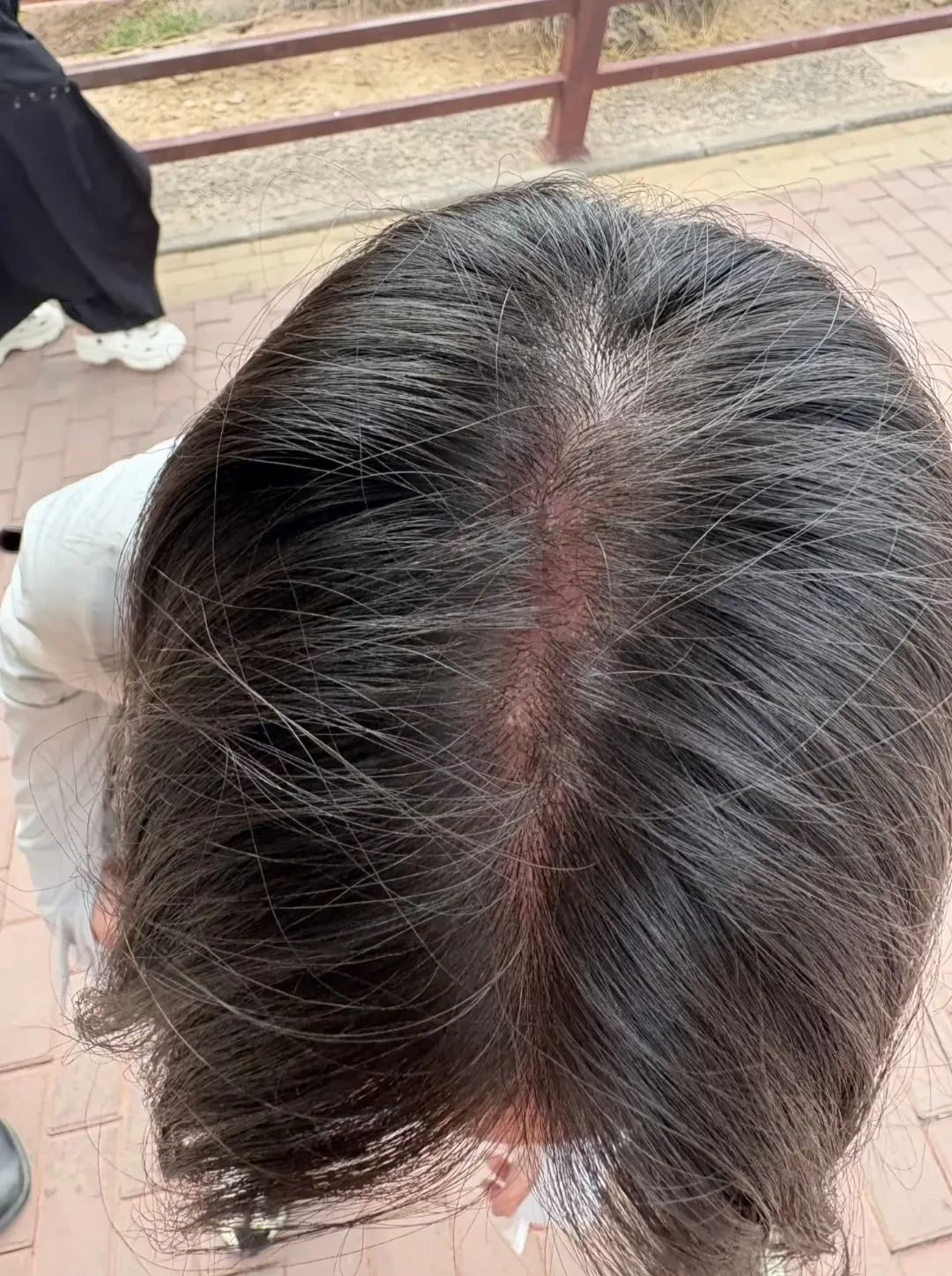 国庆去川西,最先晒伤的可能是你的头顶:翻了十几篇血泪帖,空顶帽是里面最没用的那个