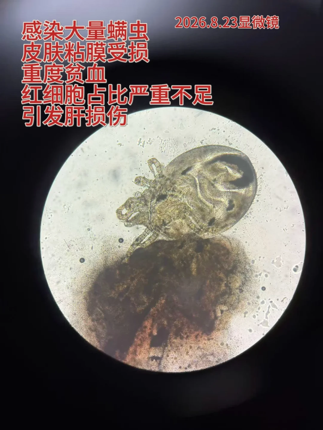 半年近60条帖子在问
