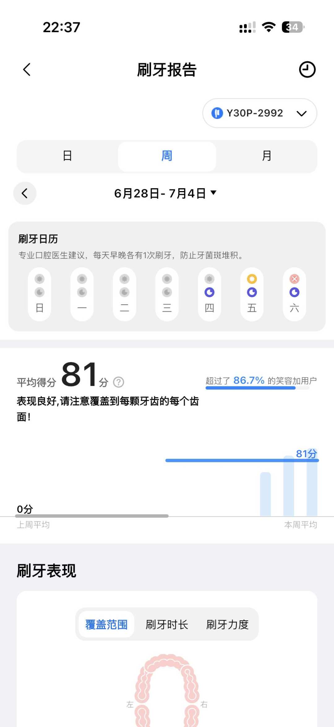 usmile Y30、Y30 Pro、Y30S怎么选:227条评论里一半在拼团,会员费、扫振和一年坏机我都翻出来了