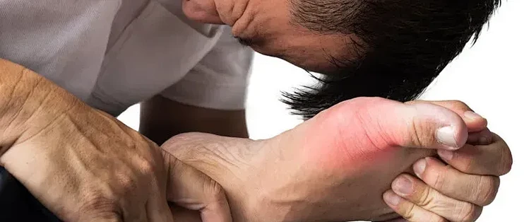 尿酸过高，上厕所会有3种迹象！希望你一个都没占