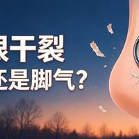 脚后跟干裂总不好？不是保湿不到位，可能是这种皮肤病