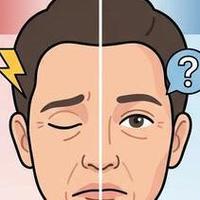 潘玮柏自曝患轻微面瘫，频繁眨眼可能是面瘫前兆