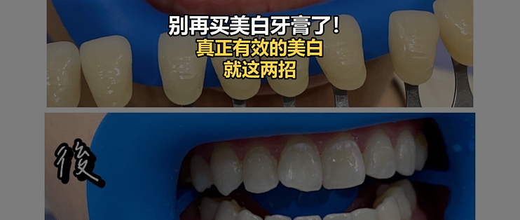 别再买美白牙膏了！牙医说真正有效的牙齿美白，就这两招