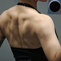健美圈"类固醇调查"这周刷屏：先别忙着指控健身房大佬，三件跟你有关的事更该看完