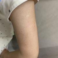 玉泽三酸身体乳被樊振东活动再次推上投流位：鸡皮党先别急着下单，"7天去鸡皮"和"毛周角化治不好"说的是两回事