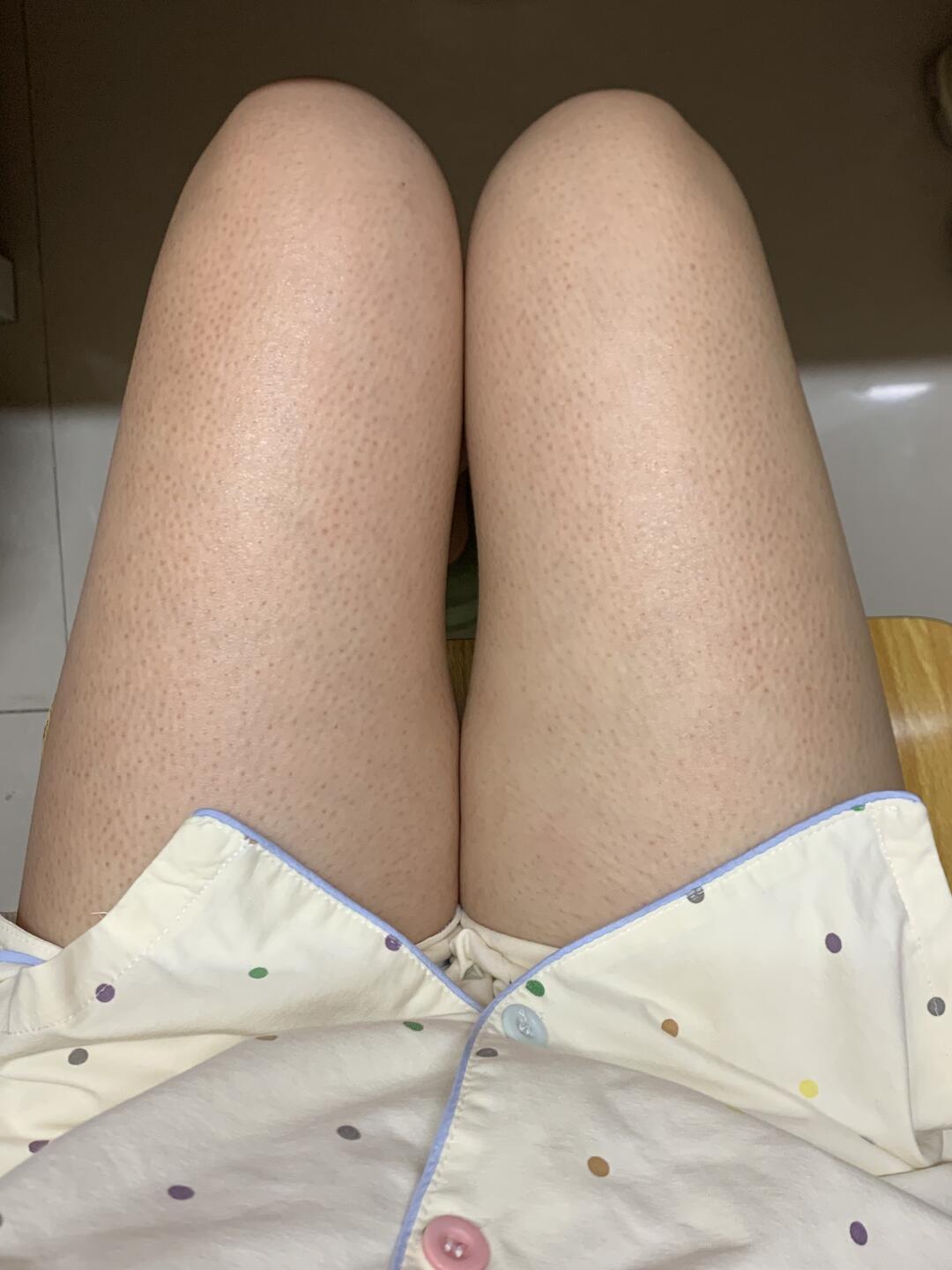 玉泽三酸身体乳被樊振东活动再次推上投流位:鸡皮党先别急着下单,