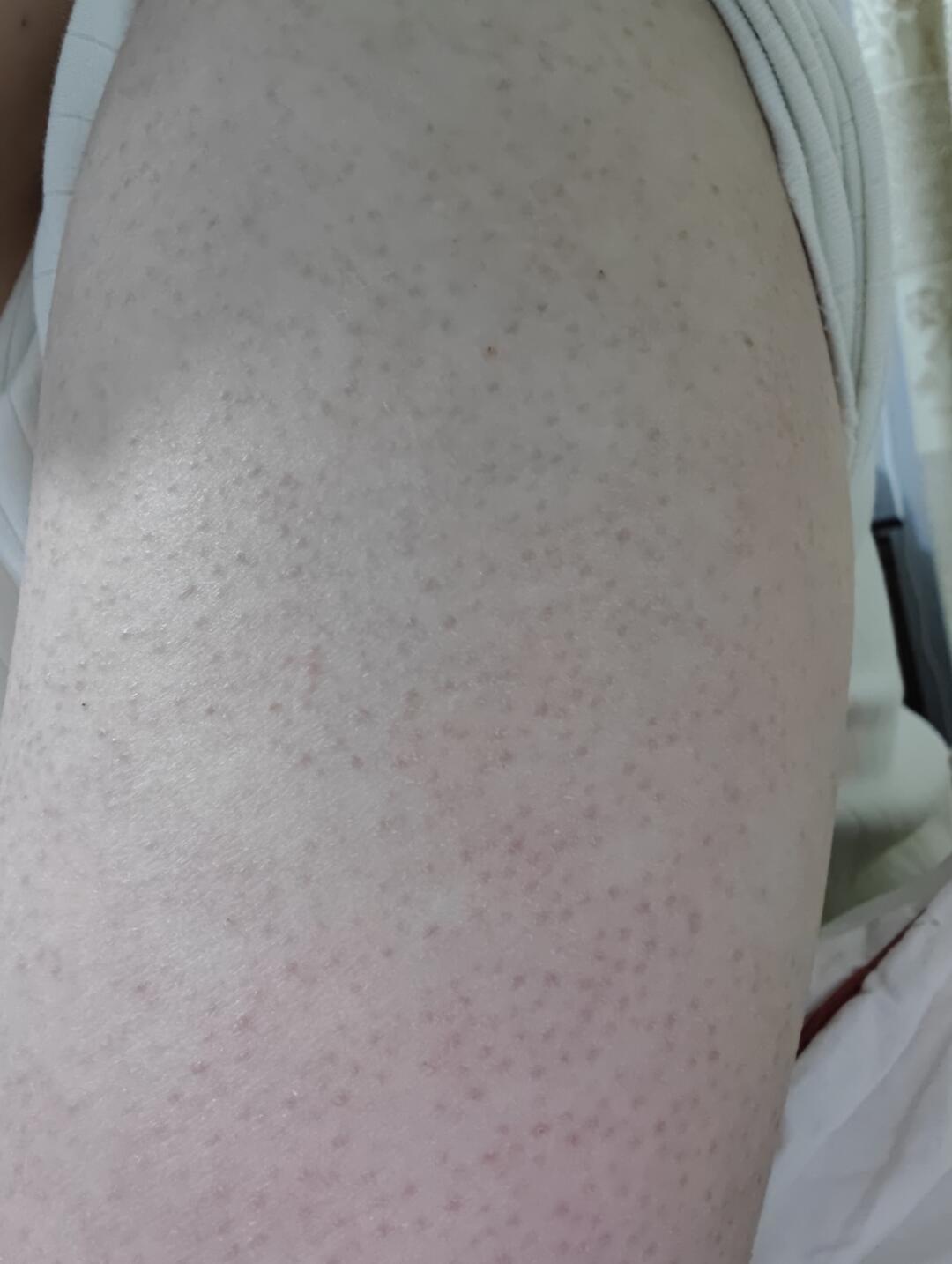 玉泽三酸身体乳被樊振东活动再次推上投流位:鸡皮党先别急着下单,